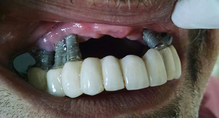 Divinyi Dentál - Tippek a rossz lehelet csökkentésére